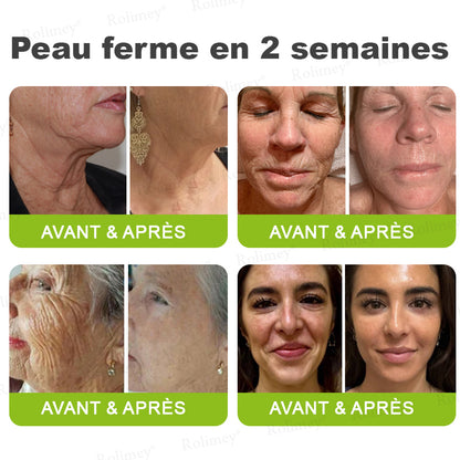 🌿👨‍⚕️💫Fabriqué et expédié depuis la France 🇫🇷 💫Rolimey® Crème Liftante Effet Botox & Vita-A Retinol Shot- Dernier jour de promotion – 70% de réduction
