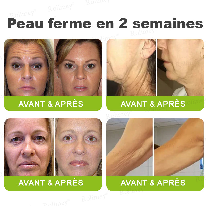 🌿👨‍⚕️💫Fabriqué et expédié depuis la France 🇫🇷 💫Rolimey® Crème Liftante Effet Botox & Vita-A Retinol Shot- Dernier jour de promotion – 70% de réduction