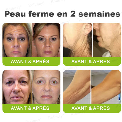 🌿👨‍⚕️💫Fabriqué et expédié depuis la France 🇫🇷 💫Rolimey® Crème Liftante Effet Botox & Vita-A Retinol Shot- Dernier jour de promotion – 70% de réduction