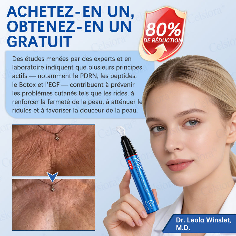 🎡🎡🎡UK HOT SALE Celsiora® PDRN Anti-Wrinkle Shot – Lift & Firming Cream