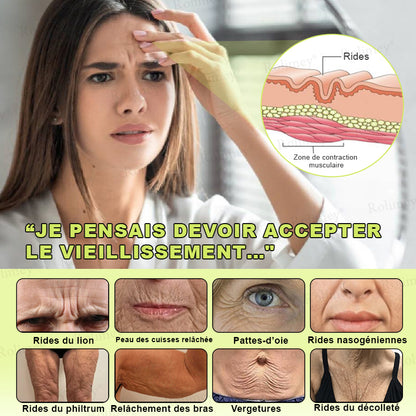 🌿👨‍⚕️💫Fabriqué et expédié depuis la France 🇫🇷 💫Rolimey® Crème Liftante Effet Botox & Vita-A Retinol Shot- Dernier jour de promotion – 70% de réduction