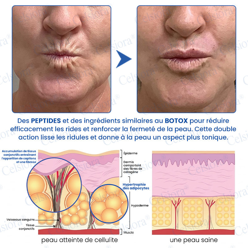 🎡🎡🎡UK HOT SALE Celsiora® PDRN Anti-Wrinkle Shot – Lift & Firming Cream