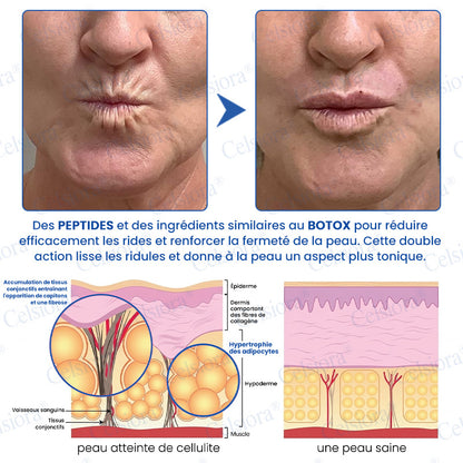 🎡🎡🎡UK HOT SALE Celsiora® PDRN Anti-Wrinkle Shot – Lift & Firming Cream
