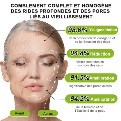 🌿👨‍⚕️💫Fabriqué et expédié depuis la France 🇫🇷 💫Rolimey® Crème Liftante Effet Botox & Vita-A Retinol Shot- Dernier jour de promotion – 70% de réduction