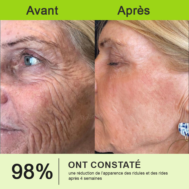 🌿👨‍⚕️💫Fabriqué et expédié depuis la France 🇫🇷 💫Rolimey® Crème Liftante Effet Botox & Vita-A Retinol Shot- Dernier jour de promotion – 70% de réduction