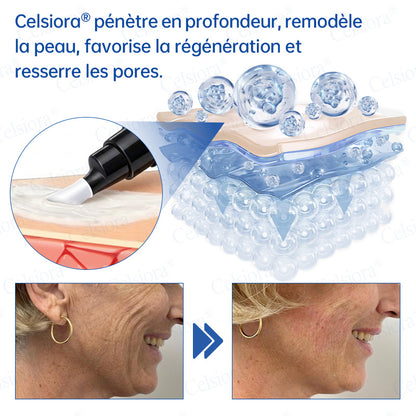 🎡🎡🎡UK HOT SALE Celsiora® PDRN Anti-Wrinkle Shot – Lift & Firming Cream