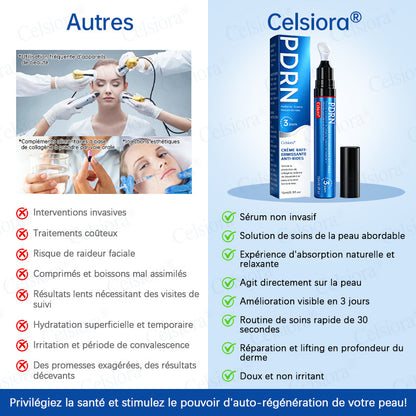 🎡🎡🎡UK HOT SALE Celsiora® PDRN Anti-Wrinkle Shot – Lift & Firming Cream