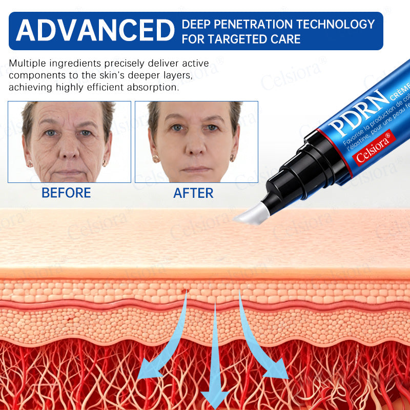 🎡🎡🎡UK HOT SALE Celsiora® PDRN Anti-Wrinkle Shot – Lift & Firming Cream