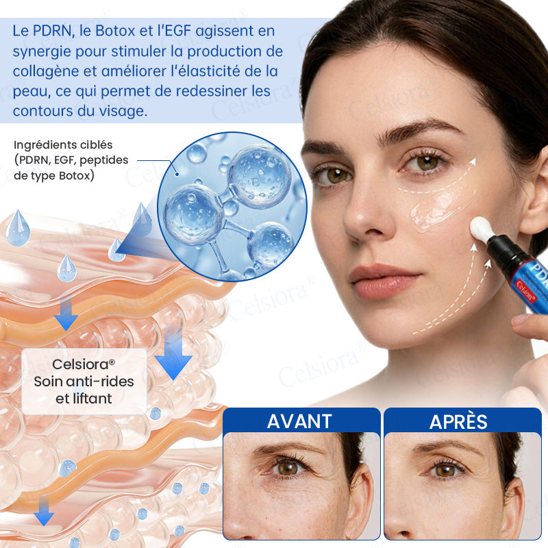 🎡🎡🎡UK HOT SALE Celsiora® PDRN Anti-Wrinkle Shot – Lift & Firming Cream