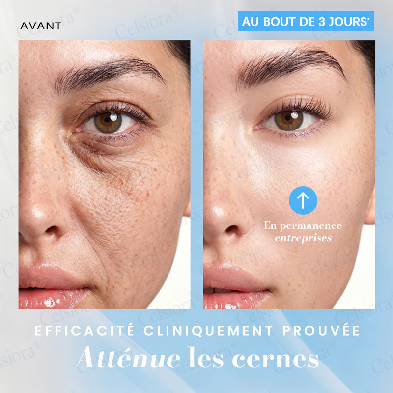 🎡🎡🎡UK HOT SALE Celsiora® PDRN Anti-Wrinkle Shot – Lift & Firming Cream