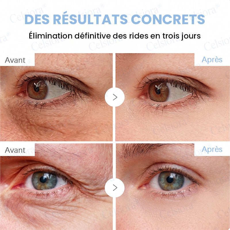 🎡🎡🎡UK HOT SALE Celsiora® PDRN Anti-Wrinkle Shot – Lift & Firming Cream