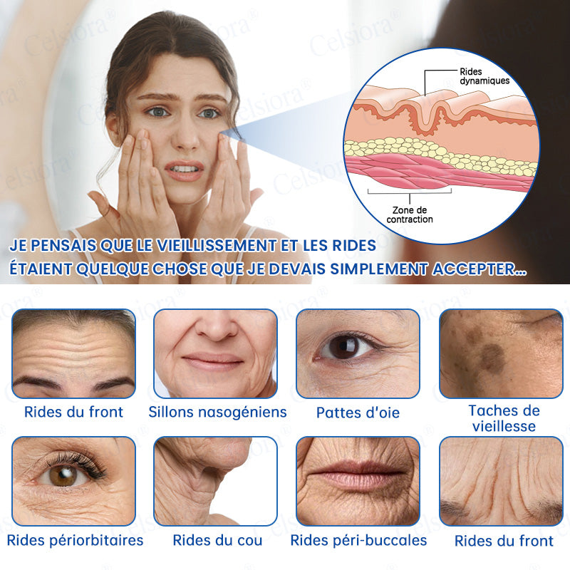 🎡🎡🎡UK HOT SALE Celsiora® PDRN Anti-Wrinkle Shot – Lift & Firming Cream