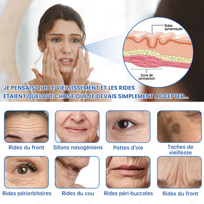 🎡🎡🎡UK HOT SALE Celsiora® PDRN Anti-Wrinkle Shot – Lift & Firming Cream