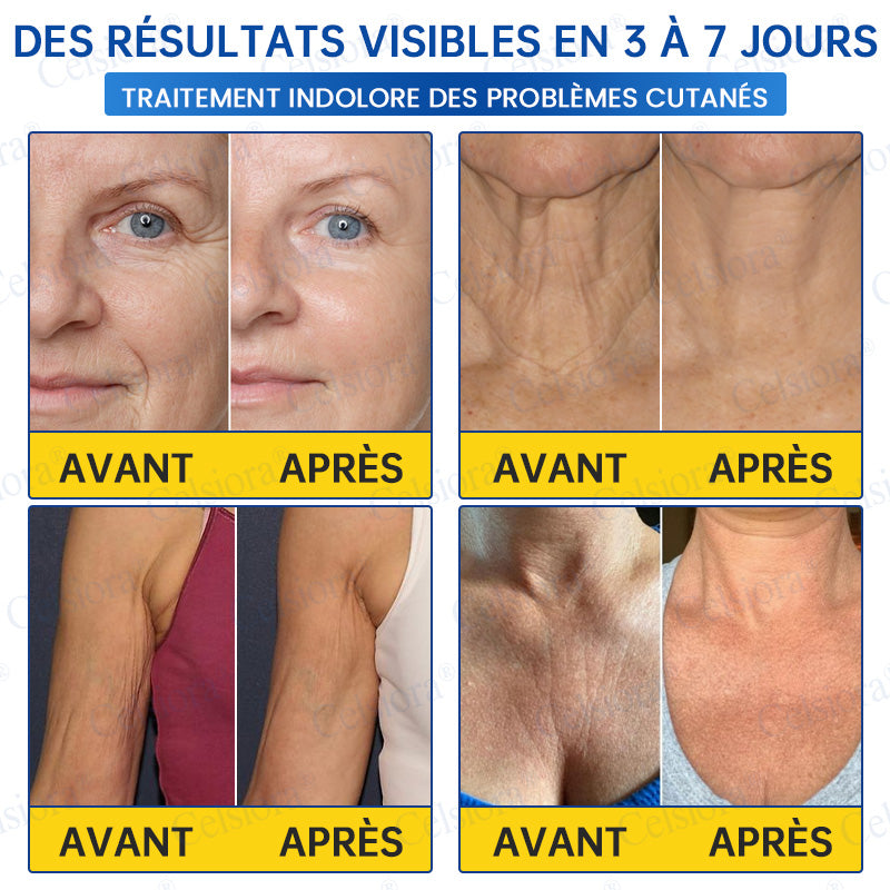 🎡🎡🎡UK HOT SALE Celsiora® PDRN Anti-Wrinkle Shot – Lift & Firming Cream