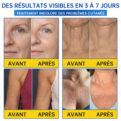 🎡🎡🎡UK HOT SALE Celsiora® PDRN Anti-Wrinkle Shot – Lift & Firming Cream