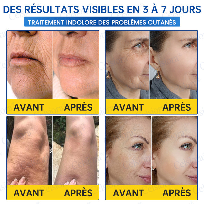 🎡🎡🎡UK HOT SALE Celsiora® PDRN Anti-Wrinkle Shot – Lift & Firming Cream