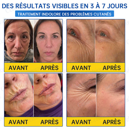 🎡🎡🎡UK HOT SALE Celsiora® PDRN Anti-Wrinkle Shot – Lift & Firming Cream